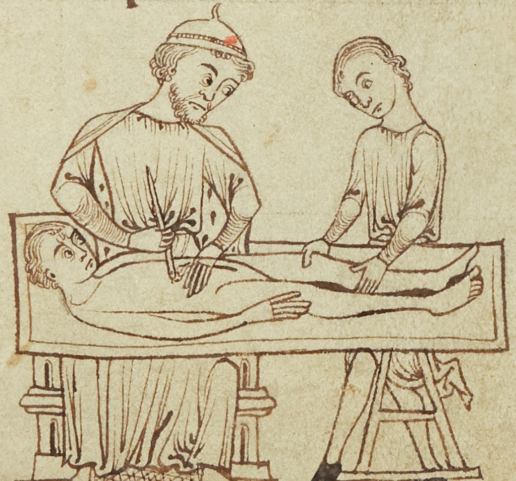 Medieval manuscript image of a doctor cutting into the stomach of a patient who lies awake and naked on a gurney; an assistant holds the patient’s left leg still.