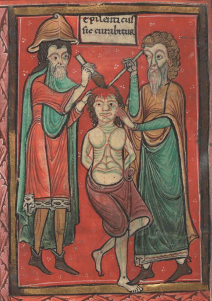 Medieval manuscript image of two doctors operating on the head of a patient whose hands are tied behind his back; each doctor holds a tool in the right hand.